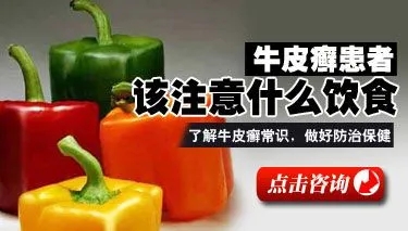 牛皮癣患者为什么不能吃油炸食品